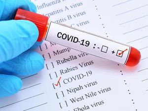 Wuhan Buka Penerbangan Internasional, Total Kasus Corona Global Tembus 30 Juta