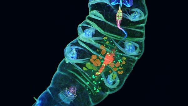 Deretan Jawara Foto Mikroskop yang Mencengangkan Mata