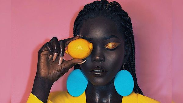 Potret Model Hitam Legam, Dulu Tinggal di Pengungsian Kini Berharta Rp 63 M