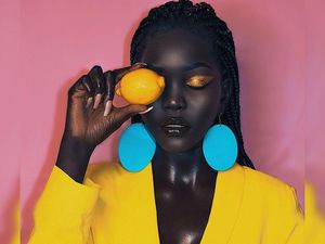 Potret Model Hitam Legam, Dulu Tinggal di Pengungsian Kini Berharta Rp 63 M