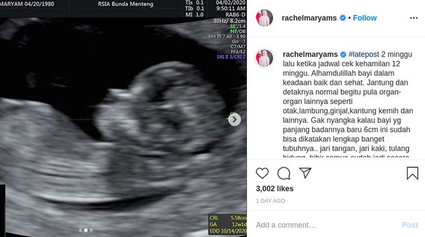 Rachel Maryam Hamil