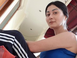 4 Fakta Sirosis Hati, Diidap Tamara Geraldine sampai Divonis Sisa Hidup 8 Bulan