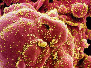 Cerita WNI di Australia yang Dicurigai Tetangga Saat Pergi Bekerja Cerita WNI di Australia yang Dicurigai Tetangga Saat Pergi Bekerja