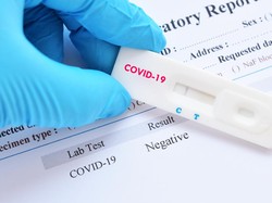 Mengenal Kit Reagen Tes Corona yang Stoknya Sering Habis di Lab