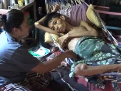 Tolong, Penderita Kanker Usus di Parepare Butuh Bantuan