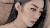 Potret Selebgram yang Viral Karena Suntik Filler untuk Bekas Gigitan Nyamuk