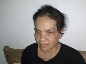 Tak Dapat Bantuan, Tukang Pijat Tunanetra Sampai Mengutang