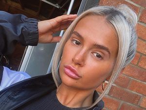 Penyesalan Artis Inggris Suntik Filler di Usia 18 Tahun, Wajahnya Jadi Kotak Penyesalan Artis Inggris Suntik Filler di Usia 18 Tahun, Wajahnya Jadi Kotak