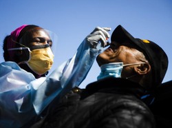 Kasus Langka, Tes Swab Hidung Picu Kebocoran Cairan Otak Seorang Pasien AS