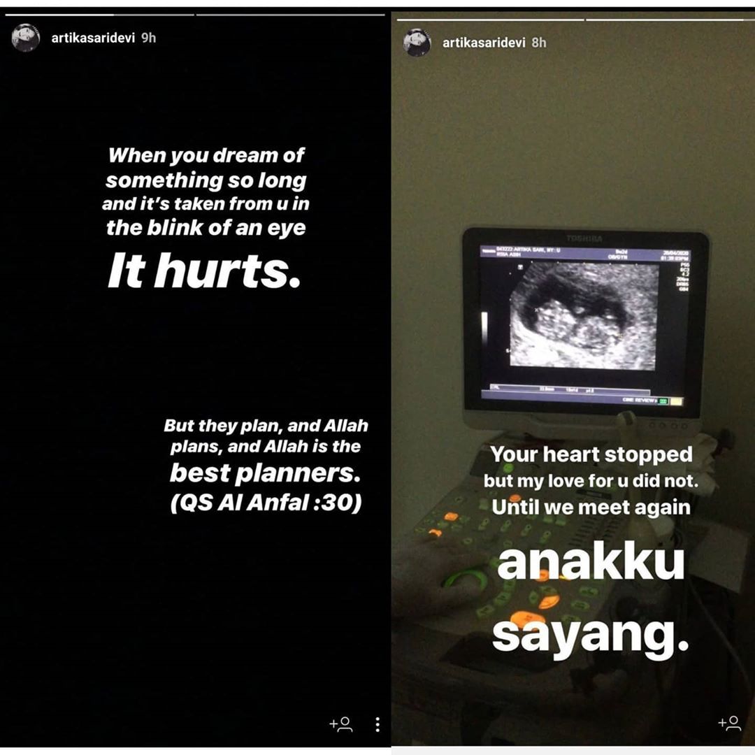 Instagram Story Artika Sari Devi