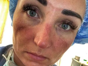 Foto Pilu Wajah Petugas Medis Pejuang Corona