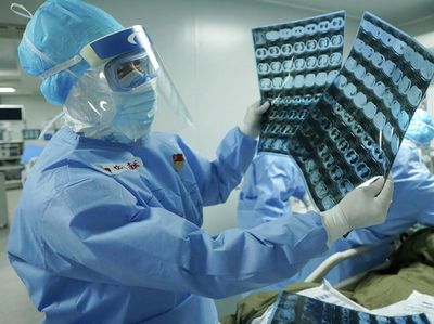 Yes! Pakar China Klaim Vaksin Corona Bisa Dipakai Awal Tahun Depan