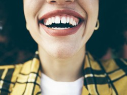 Perawatan Gigi Estetik yang Bakal Booming di 2024, Ada Veneer dan Bleaching