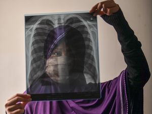 Studi Sebut Sebagian Besar Pasien Corona Kebal Sampai 6 Bulan