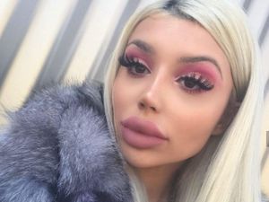 Dilarang ke Klinik Kecantikan, Wanita Ini Belajar Suntik Filler Sendiri di Rumah Dilarang ke Klinik Kecantikan, Wanita Ini Belajar Suntik Filler Sendiri di Rumah