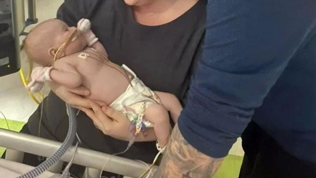 Bayi 6 Bulan Penderita Kelainan Jantung Ini Sembuh dari Corona