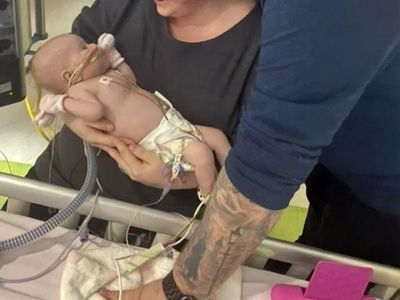 Bayi 6 Bulan Penderita Kelainan Jantung Ini Sembuh dari Corona