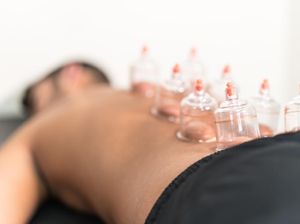 Apa Itu Terapi Bekam? Ini Manfaat, Metode, dan Efeknya Apa Itu Terapi Bekam? Ini Manfaat, Metode, dan Efeknya