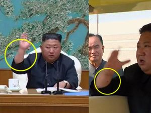 Tanda Misterius di Lengan Kim Jong Un, Kemungkinan Bekas Ambil Darah? Tanda Misterius di Lengan Kim Jong Un, Kemungkinan Bekas Ambil Darah?