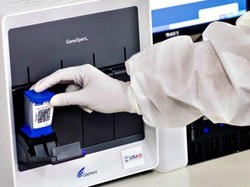 RI Kerahkan Alat Tes TBC untuk Tes Corona, 45 Menit Keluar Hasilnya