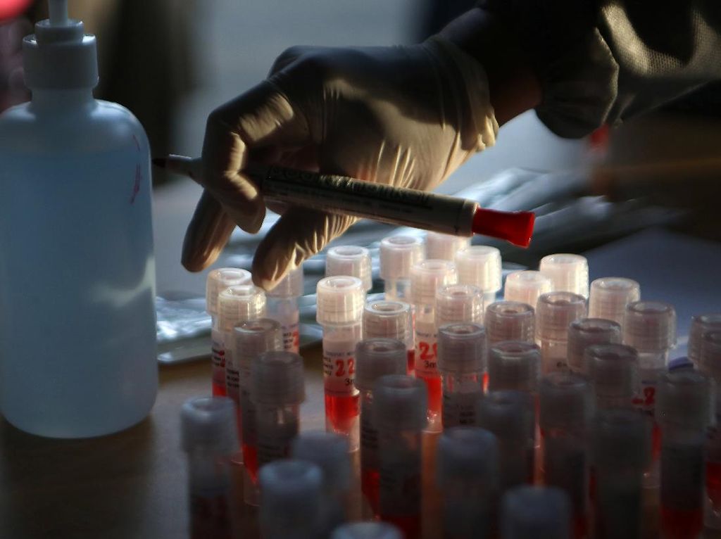Pakar: Belum Ada Tanda-tanda Pandemi COVID-19 di Indonesia Akan Berakhir