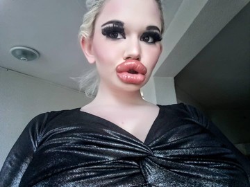 Wanita dengan Bibir Terbesar di Dunia Kecanduan Filler, Ini Penampilannya Dulu