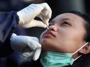 Per 17 Mei, 187.965 Spesimen Telah Diperiksa Terkait Covid-19