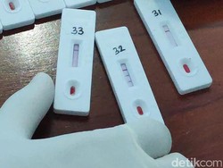 205 Warga Rungkut Lor gang 7 Surabaya Rapid Test, 49 Reaktif