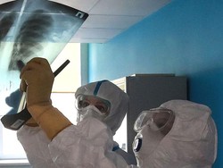 Dokter China Periksa Paru-paru Pasien Corona dengan Kecerdasan Buatan