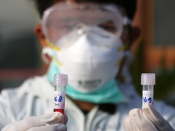 Kejar Target 20 Ribu Sehari, 13.333 Spesimen terkait Corona Diperiksa 5 Juni