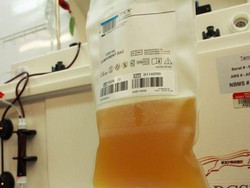 Australia Kembangkan Plasma dari Penderita COVID-19 untuk Pengobatan