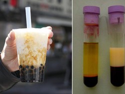 Minum Bubble Tea 6 Bulan, Warna Plasma Darah Pria Ini Jadi Putih Susu!