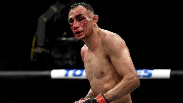 JACKSONVILLE, FLORIDA - MAY 09: Tony Ferguson of the United States looks on against Justin Gaethje of the United States after their Interim lightweight title fight during UFC 249 at VyStar Veterans Memorial Arena on May 09, 2020 in Jacksonville, Florida. Douglas P. DeFelice/Getty Images/AFP