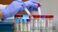 Test PCR Deteksi 3 Gen Sekaligus