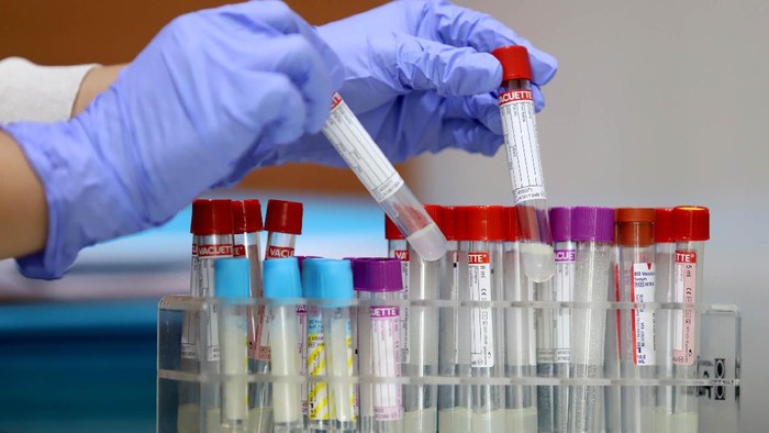 Prodia menyediakan pemeriksaan SARS-CoV-2 RNA dengan metode real-time RT-PCR (PCR COVID-19) yang mendeteksi 3 (tiga) target gen sekaligus yaitu Gen E, N, dan RdRP sesuai dengan protokol yang ditetapkan World Health Organization (WHO)