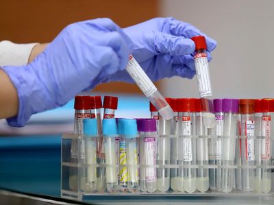 Test PCR Deteksi 3 Gen Sekaligus