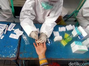 Tes Antibodi Ini Diklaim Mampu Deteksi dengan Akurasi 100 Persen