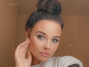 Miris, Kulit Mulus Model Cantik Terbakar Setelah Produk Tanning Meledak