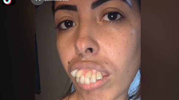 Foto: Transformasi Wanita Bergigi Tonggos Ini Viral, Netizen Ternyata Di-prank