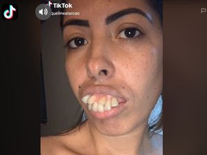 Foto: Transformasi Wanita Bergigi Tonggos Ini Viral, Netizen Ternyata Di-prank