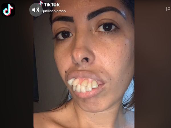 Foto: Transformasi Wanita Bergigi Tonggos Ini Viral, Netizen Ternyata Di-prank