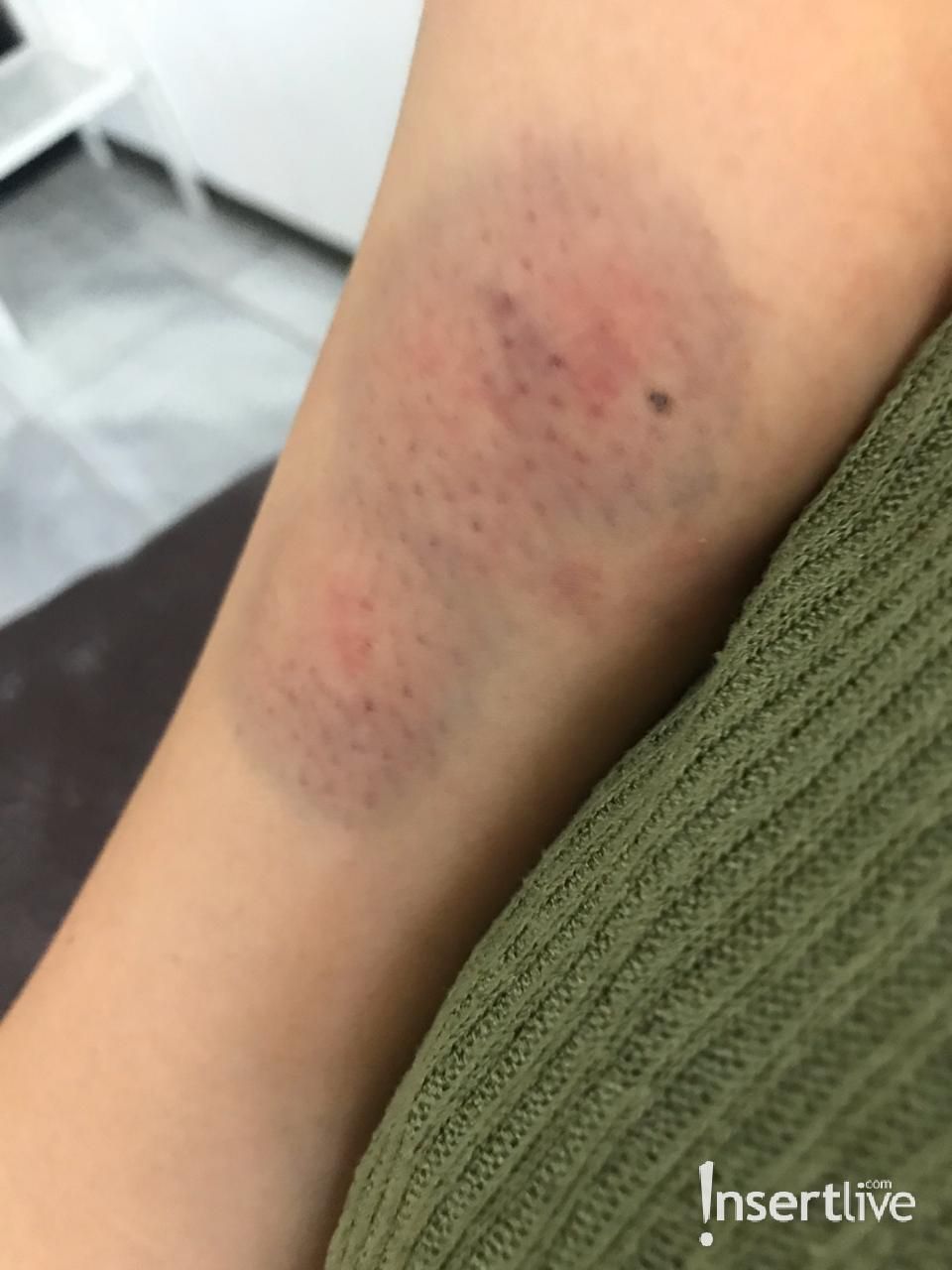Foto Bukti KDRT Aska Ongi