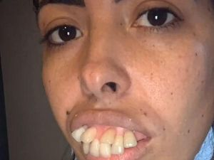 Transformasi Wanita Bergigi Tonggos Jadi Viral, Berujung Netizen Kena Prank