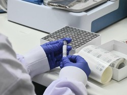 Pamitan Tim Waspada COVID-19 Eijkman Disambut Sedih dan Tanda Tanya