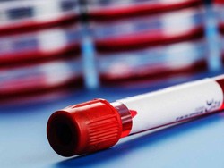 Temuan Baru Soal Kekebalan Tubuh Munculkan Harapan Penanganan Corona