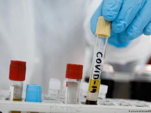 Kekebalan Virus Corona Disebut Hanya Bertahan 6 Bulan Kekebalan Virus Corona Disebut Hanya Bertahan 6 Bulan