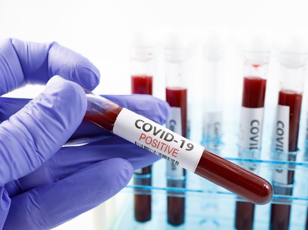 5 Fakta Penting Soal D-dimer, Indikator Bekuan Darah pada COVID-19