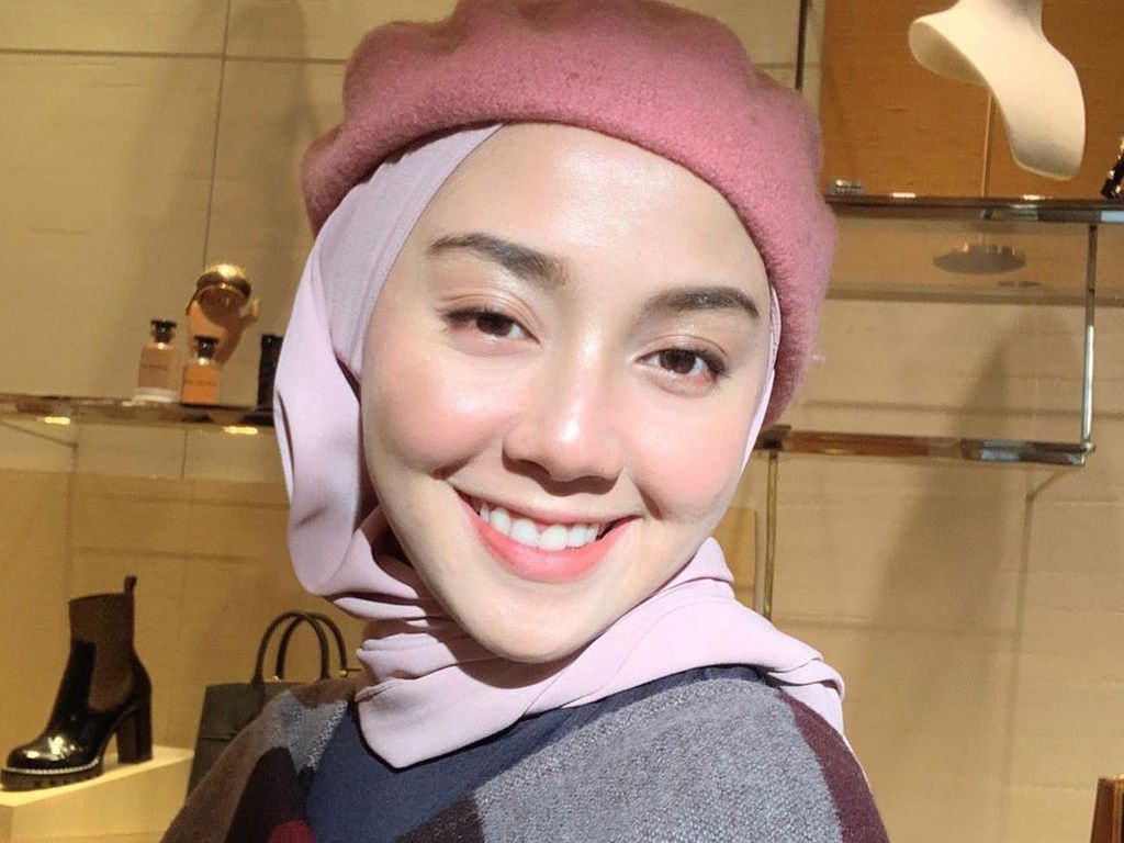 Penampilan Cantik Wanita yang Dulu Dibully Muka Sampah karena Gigi Ompong Penampilan Cantik Wanita yang Dulu Dibully Muka Sampah karena Gigi Ompong