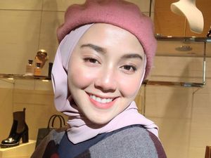 Penampilan Cantik Wanita yang Dulu Dibully Muka Sampah karena Gigi Ompong Penampilan Cantik Wanita yang Dulu Dibully Muka Sampah karena Gigi Ompong