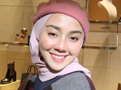 Penampilan Cantik Wanita yang Dulu Dibully Muka Sampah karena Gigi Ompong